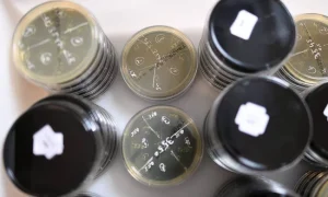 μικροβιολογική ανάλυση legionella